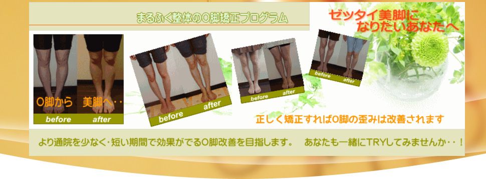 奈良　生駒のO脚矯正　まるふく総合整体院　正しく矯正すればO脚は改善されます